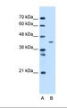 MTCH1 Antibody - Lane A: Marker. Lane B: HepG2 cell lysate. Antibody concentration: 1.0 ug/ml. Gel concentration: 12%.  This image was taken for the unconjugated form of this product. Other forms have not been tested.