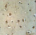 MTCH2 Antibody - MTCH2 Antibody immunohistochemistry of formalin-fixed and paraffin-embedded human brain tissue followed by peroxidase-conjugated secondary antibody and DAB staining.