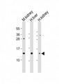 MTCP1 Antibody - All lanes: Anti-MTCP1 Antibody (C-Term) at 1:2000 dilution. Lane 1: mouse kidney lysates. Lane 2: human liver lysates. Lane 3: human kidney lysates Lysates/proteins at 20 ug per lane. Secondary Goat Anti-Rabbit IgG, (H+L), Peroxidase conjugated at 1:10000 dilution. Predicted band size: 13 kDa. Blocking/Dilution buffer: 5% NFDM/TBST.