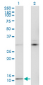 MTCP1 Antibody - Western Blot analysis of MTCP1 expression in transfected 293T cell line by MTCP1 monoclonal antibody (M05), clone 1G12.Lane 1: MTCP1 transfected lysate (Predicted MW: 7.7 KDa).Lane 2: Non-transfected lysate.