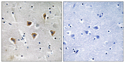 MTERF1 Antibody - Immunohistochemistry analysis of paraffin-embedded human brain tissue, using MTERF Antibody. The picture on the right is blocked with the synthesized peptide.