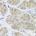 MTERF2 / MTERFD3 Antibody - Immunohistochemistry of paraffin-embedded human stomach tissue.