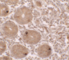 MTERF4 / MTERFD2 Antibody - Immunohistochemistry of MTERFD2 in human small intestine tissue with MTERFD2 antibody at 2.5 ug/ml.
