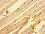 MTERF4 / MTERFD2 Antibody - Immunohistochemistry of paraffin-embedded human skeletal muscle tissue at dilution of 1:100