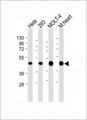 MTHFD2 Antibody - All lanes: Anti-MTHFD2 Antibody (C-term) at 1:4000 dilution Lane 1: Hela whole cell lysate Lane 2: 293 whole cell lysate Lane 3: MOLT-4 whole cell lysate Lane 4: Mouse heart lysate Lysates/proteins at 20 µg per lane. Secondary Goat Anti-mouse IgG, (H+L), Peroxidase conjugated at 1/10000 dilution. Predicted band size: 38 kDa Blocking/Dilution buffer: 5% NFDM/TBST.