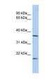MTHFD2L Antibody - MTHFD2L antibody Western blot of Fetal Lung lysate. This image was taken for the unconjugated form of this product. Other forms have not been tested.