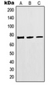 MTHFR Antibody - Western blot analysis of MTHFR expression in HEK293 (A); Jurkat (B); A549 (C) whole cell lysates.