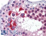 MTL5 / TESMIN Antibody - Anti-MTL5 antibody IHC of human testis. Immunohistochemistry of formalin-fixed, paraffin-embedded tissue after heat-induced antigen retrieval. Antibody concentration 5 ug/ml.  This image was taken for the unconjugated form of this product. Other forms have not been tested.