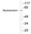 MTM1 / Myotubularin Antibody - Western blot analysis of lysate from COLO205 cells, using Myotubularin antibody.