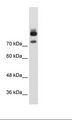 MTMR1 Antibody - HepG2 Cell Lysate.  This image was taken for the unconjugated form of this product. Other forms have not been tested.