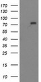 MTMR2 Antibody - HEK293T cells were transfected with the pCMV6-ENTRY control (Left lane) or pCMV6-ENTRY MTMR2 (Right lane) cDNA for 48 hrs and lysed. Equivalent amounts of cell lysates (5 ug per lane) were separated by SDS-PAGE and immunoblotted with anti-MTMR2.