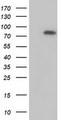 MTMR2 Antibody - HEK293T cells were transfected with the pCMV6-ENTRY control (Left lane) or pCMV6-ENTRY MTMR2 (Right lane) cDNA for 48 hrs and lysed. Equivalent amounts of cell lysates (5 ug per lane) were separated by SDS-PAGE and immunoblotted with anti-MTMR2.