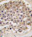 MTOR Antibody - Formalin-fixed and paraffin-embedded human testis tissue reacted with FRAP1-pS2481, which was peroxidase-conjugated to the secondary antibody, followed by DAB staining. This data demonstrates the use of this antibody for immunohistochemistry; clinical relevance has not been evaluated.