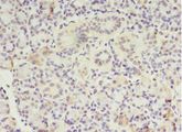 MTRR Antibody - Immunohistochemistry of paraffin-embedded human pancreas tissue using antibody at 1:100 dilution.  This image was taken for the unconjugated form of this product. Other forms have not been tested.