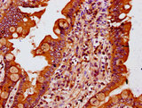 MTSS1 / MIM Antibody - Immunohistochemistry Dilution at 1:400 and staining in paraffin-embedded human small intestine tissue performed on a Leica BondTM system. After dewaxing and hydration, antigen retrieval was mediated by high pressure in a citrate buffer (pH 6.0). Section was blocked with 10% normal Goat serum 30min at RT. Then primary antibody (1% BSA) was incubated at 4°C overnight. The primary is detected by a biotinylated Secondary antibody and visualized using an HRP conjugated SP system.