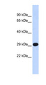 MtTFA / TFAM Antibody - TFAM antibody Western blot of Mouse Muscle lysate. This image was taken for the unconjugated form of this product. Other forms have not been tested.