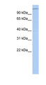 MTUS1 Antibody - MTUS1 antibody Western blot of HeLa lysate. This image was taken for the unconjugated form of this product. Other forms have not been tested.