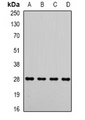 MTX2 Antibody - Western blot analysis of Metaxin-2 expression in MCF7 (A); HepG2 (B); mouse liver (C); mouse heart (D) whole cell lysates.