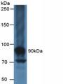 MUC16 / CA125 Antibody - Western Blot; Sample: Human Liver Tissue.