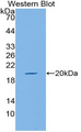 MUC5AC Antibody - Western blot of recombinant MUC5AC.  This image was taken for the unconjugated form of this product. Other forms have not been tested.