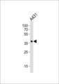 MUL1 / MULAN Antibody - Western blot of lysate from A431 cell line with MUL1 Antibody. Antibody was diluted at 1:1000. A goat anti-rabbit IgG H&L (HRP) at 1:10000 dilution was used as the secondary antibody. Lysate at 35 ug.