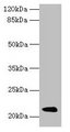 Mup8 + Mup11 Antibody - Western blot All lanes: Major urinary proteins 11 and 8 antibody at 2µg/ml + Mouse liver tissue Secondary Goat polyclonal to rabbit IgG at 1/10000 dilution Predicted band size: 18 kDa Observed band size: 18 kDa