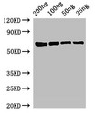 mutL Antibody - Positive WB detected in Recombinant protein;All lanes:mutL antibody at 3?g/ml;Secondary;Goat polyclonal to rabbit IgG at 1/50000 dilution;predicted band size: 68 KDa;observed band size: 68 KDa;
