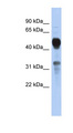 MVK Antibody - MVK antibody Western blot of 293T cell lysate. This image was taken for the unconjugated form of this product. Other forms have not been tested.