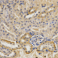 MVK Antibody - Immunohistochemistry of paraffin-embedded mouse kidney tissue.