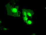 MX1 / MX Antibody - Anti-MX1 mouse monoclonal antibody  immunofluorescent staining of COS7 cells transiently transfected by pCMV6-ENTRY MX1.