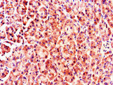MX1 / MX Antibody - Immunohistochemistry of paraffin-embedded human pancreatic tissue using MX1 Antibody at dilution of 1:100