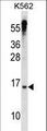 MXD3 / MAD3 Antibody - MXD3 Antibody western blot of K562 cell line lysates (35 ug/lane). The MXD3 antibody detected the MXD3 protein (arrow).