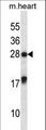 MXI1 / MAD2 Antibody - MXI1 Antibody western blot of mouse heart tissue lysates (35 ug/lane). The MXI1 antibody detected the MXI1 protein (arrow).