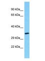 MYADML2 Antibody - MYADML2 antibody Western Blot of HeLa. Antibody dilution: 1 ug/ml.  This image was taken for the unconjugated form of this product. Other forms have not been tested.