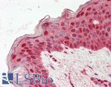 MYB / c-Myb Antibody - Human Skin: Formalin-Fixed, Paraffin-Embedded (FFPE).  This image was taken for the unconjugated form of this product. Other forms have not been tested.