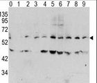 MYC / c-Myc Antibody - Western blot of Phospho-MYC-T58 Antibody in human TPA activated HeLa cell line lysates. Phospho-MYC (arrow) was detected using the purified antibody. (0: without TPA; 1: 60 ug/ml TPA, 15min; 2: 60 ug/ml TPA, 30min; 3: 60 ug/ml TPA, 45min; 4: 125 ug/ml TPA, 15min; 5: 125 ug/ml TPA, 30min; 6: 125 ug/ml TPA, 45min; 7: 250 ug/ml TPA, 15min; 8: 250 ug/ml TPA, 30min; 9: 250 ug/ml, 45min)