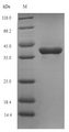 tmk / Thymidylate Kinase Protein - (Tris-Glycine gel) Discontinuous SDS-PAGE (reduced) with 5% enrichment gel and 15% separation gel.
