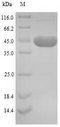 46 kDa surface antigen Protein - (Tris-Glycine gel) Discontinuous SDS-PAGE (reduced) with 5% enrichment gel and 15% separation gel.