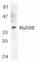 MYD88 Antibody - Western blot of Jurkat whole cell lysate probed with Rabbit anti-MyD88 (RABBIT ANTI MyD88 (C-TERMINAL)).
