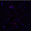 MYD88 Antibody - Immunofluorescence of MyD88 in Jurkat cells with MyD88 antibody at 20 µg/ml.Red: MYD88 Antibody  Blue: DAPI staining