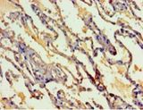 MYEF2 Antibody - Immunohistochemistry of paraffin-embedded human lung using antibody at 1:100 dilution.  This image was taken for the unconjugated form of this product. Other forms have not been tested.