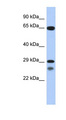 MYF5 / MYF 5 Antibody - MYF5 antibody Western blot of Placenta lysate. This image was taken for the unconjugated form of this product. Other forms have not been tested.