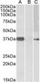 MYF6 / MRF4 Antibody - HEK293 lysate (10ug protein in RIPA buffer) overexpressing Human MYF6 with MYC tag probed with (0.5ug/ml) in Lane A and probed with anti-MYC Tag (1/1000) in lane C. Mock-transfected HEK293 probed (0.5mg/ml) in Lane B. Primary incubati