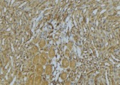 MYH4 Antibody - 1:100 staining mouse kidney tissue by IHC-P. The sample was formaldehyde fixed and a heat mediated antigen retrieval step in citrate buffer was performed. The sample was then blocked and incubated with the antibody for 1.5 hours at 22°C. An HRP conjugated goat anti-rabbit antibody was used as the secondary.
