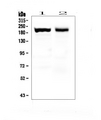 MYH7 Antibody - Western blot analysis of Myosin(Skeletal, Slow) using anti-Myosin(Skeletal, Slow) antibody. Electrophoresis was performed on a 5-20% SDS-PAGE gel at 70V (Stacking gel) / 90V (Resolving gel) for 2-3 hours. The sample well of each lane was loaded with 50ug of sample under reducing conditions. Lane 1: mouse skeletal muscle tissue lysates, Lane 2: rat skeletal muscle tissue lysates. After Electrophoresis, proteins were transferred to a Nitrocellulose membrane at 150mA for 50-90 minutes. Blocked the membrane with 5% Non-fat Milk/ TBS for 1.5 hour at RT. The membrane was incubated with mouse anti-Myosin(Skeletal, Slow) antigen affinity purified monoclonal antibody at 0.5 µg/mL overnight at 4°C, then washed with TBS-0.1% Tween 3 times with 5 minutes each and probed with a goat anti-mouse IgG-HRP secondary antibody at a dilution of 1:10000 for 1.5 hour at RT. The signal is developed using an Enhanced Chemiluminescent detection (ECL) kit with Tanon 5200 system. A specific band was detected for Myosin(Skeletal, Slow) at approximately 200-220KD. The expected band size for Myosin(Skeletal, Slow) is at 220KD.