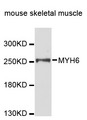 MYHC / MYH6 Antibody - Western blot analysis of extracts of mouse skeletal muscle cells.