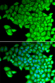 MYL2 Antibody - Immunofluorescence analysis of HeLa cells.