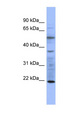 MYL3 Antibody - MYL3 antibody Western blot of COLO205 cell lysate. This image was taken for the unconjugated form of this product. Other forms have not been tested.