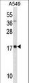 MYL4 Antibody - MYL4 Antibody western blot of A549 cell line lysates (35 ug/lane). The MYL4 antibody detected the MYL4 protein (arrow).