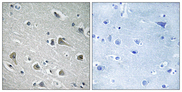 MYLIP / IDOL Antibody - Immunohistochemistry analysis of paraffin-embedded human brain tissue, using MYLIP Antibody. The picture on the right is blocked with the synthesized peptide.